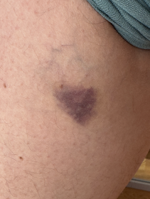 Pentyll Pulse 90 tbl