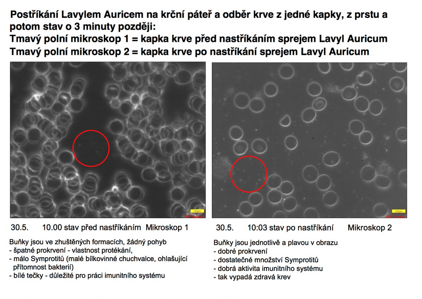 KREV POD MIKROSKOPEM